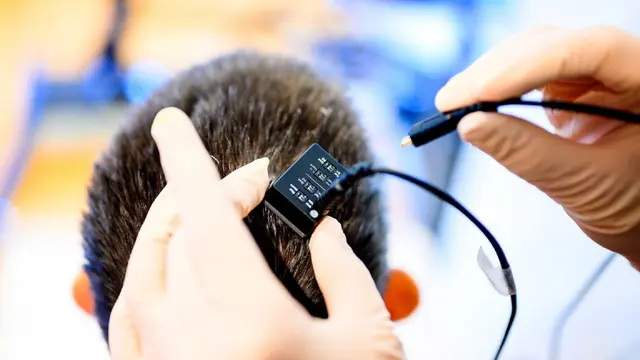 脑机接口技术让瘫痪 18 年的患者通过 AI 实时“说话”，延迟仅 1 秒