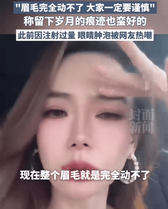 戚薇大方承认医美过度：打僵了整个眉毛完全动不了