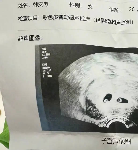 韩安冉发文称三胎已经引产 在全麻整容后意外怀孕