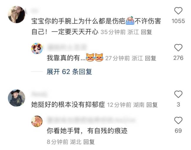 金子涵剪寸头后晒私照分享生活 手腕上多条伤疤