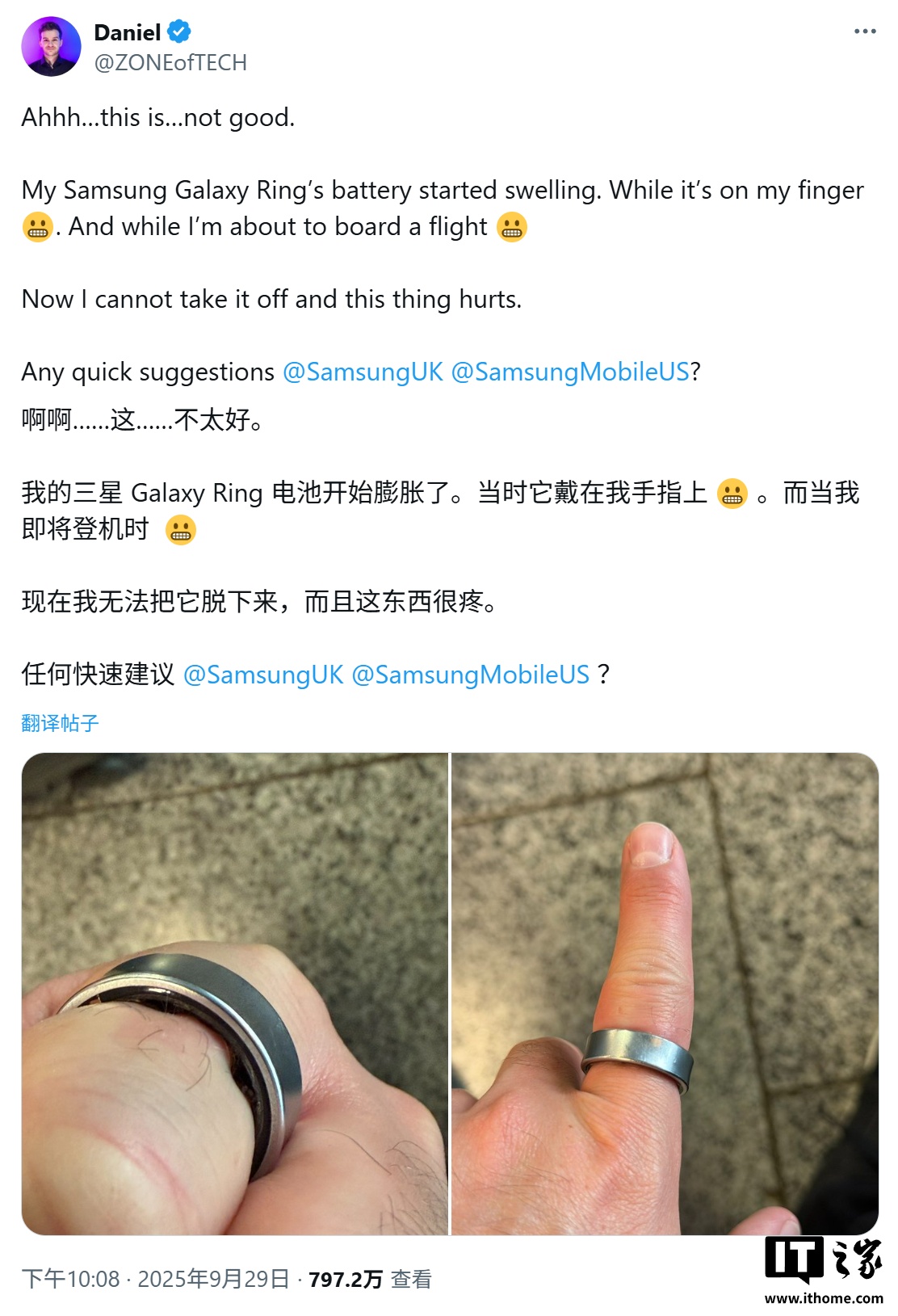 三星 Galaxy Ring 智能戒指突发电池鼓包，用户手指被卡住紧急送医