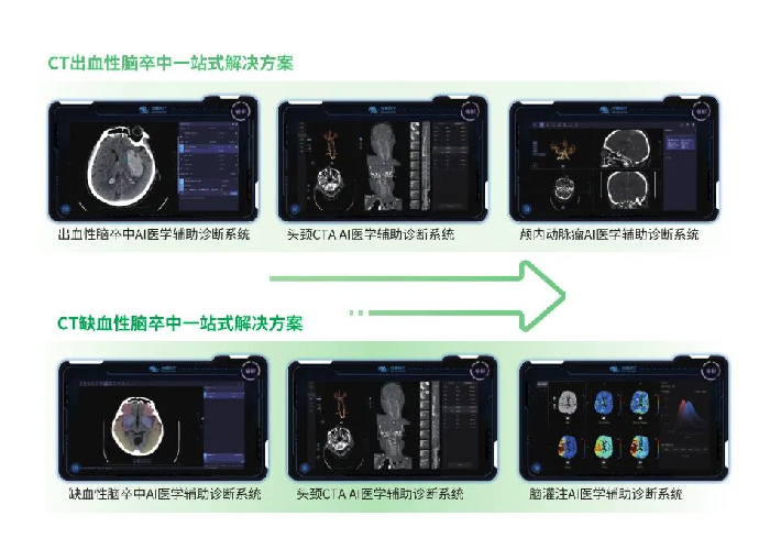 突破经验依赖!深睿医疗多模态MRI科研实现AIS早期精准评估