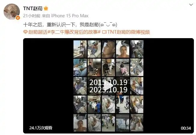 演员赵荀公布重伤十年治疗画面：从“李二牛”到“重生的自己”