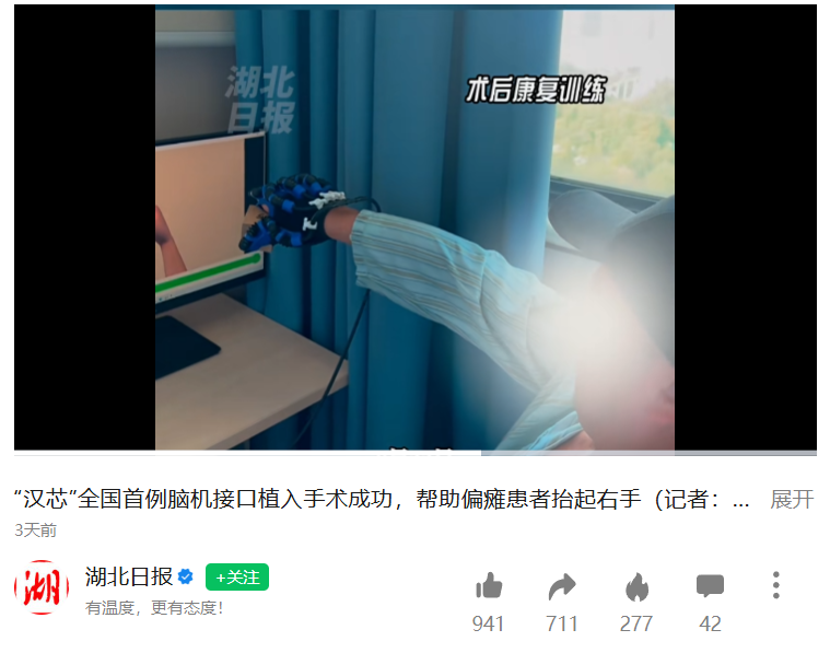 衷华脑机全国产自主研发脑机芯片首次临床植入成功，偏瘫患者重获“抓握之力”