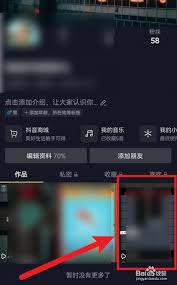 抖音短视频怎样置顶自己的作品