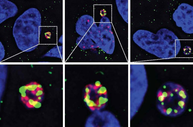 破解数十年谜题：科学家首次破解癌症耐药性谜题，锁定染色体碎裂“元凶”