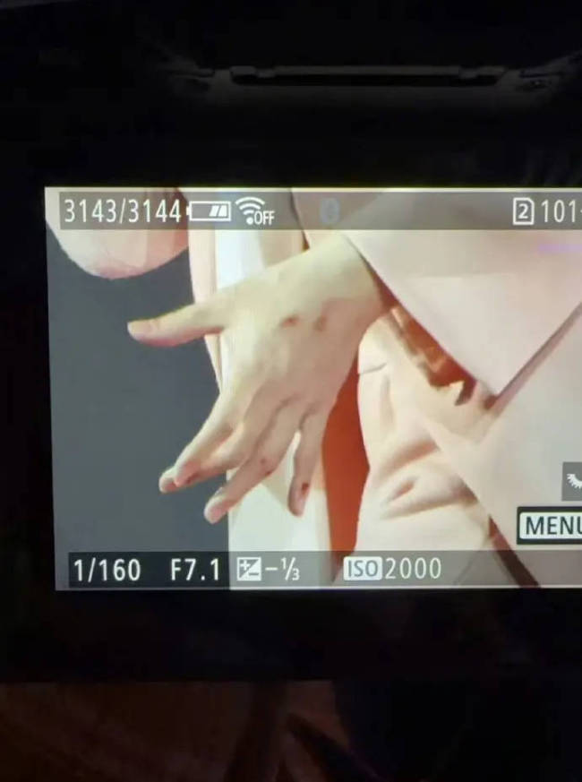 阿信F4演唱会不慎摔下舞台 手指流血仍继续演唱